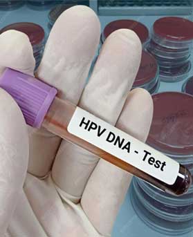 HPV-DNA Testi Jinekolog Op.Dr Emrah Kızıldağ Kadın hastalıkları ve Doğum Uzmanı Şişli İstanbul Avrupa Yakası En iyi Kadın Doğum Doktorları Tavsiyesi ve yorumları