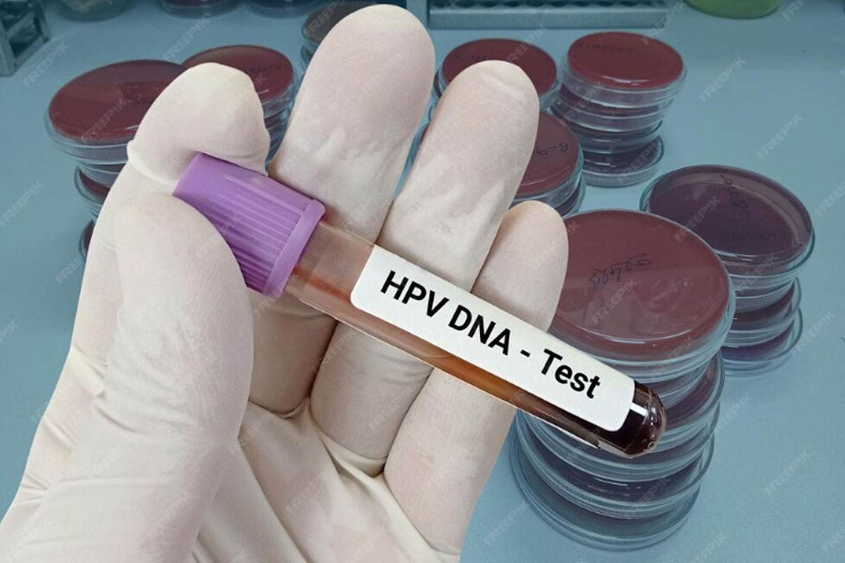HPV / DNA Testleri - Jinekolog Op.Dr Emrah Kızıldağ Kadın Hastalıkları ve Doğum Uzmanı Şişli İstanbul Avrupa Yakası Kadın Doğum Doktorları en iyi kadın doğum uzmanı tavsiye ve yorumları Şişli'de İstanbuldaki