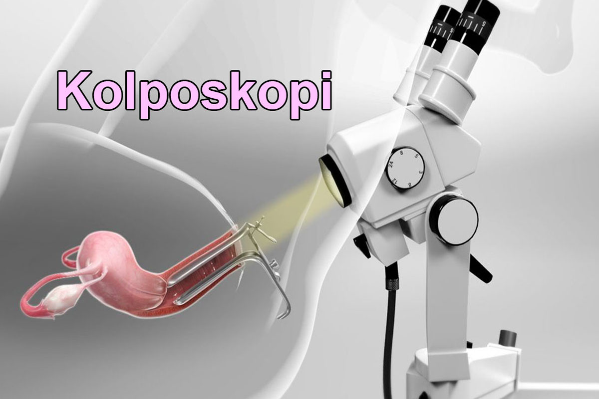 Kolposkopi - Jinekolog Op.Dr Emrah Kızıldağ Kadın Hastalıkları ve Doğum Uzmanı Şişli İstanbul Avrupa Yakası Kadın Doğum Doktorları en iyi kadın doğum uzmanı tavsiye ve yorumları Şişli'de İstanbuldaki